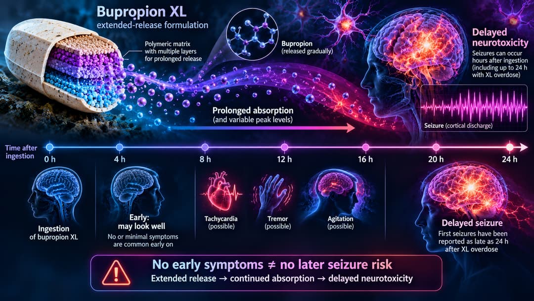 Timeline showing delayed seizure risk after extended-release bupropion overdose despite an initially normal neurologic examination.